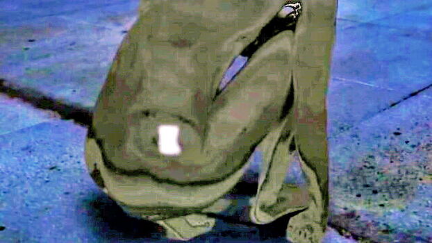 Fernlund leaked private photo uncensored HD quality