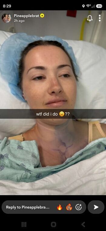 Pineapplebrat  page leaked private photo uncensored HD quality