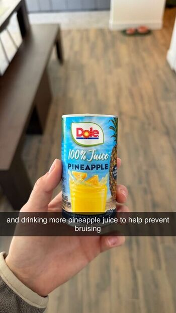 Pineapplebrat leaked private photo uncensored HD quality