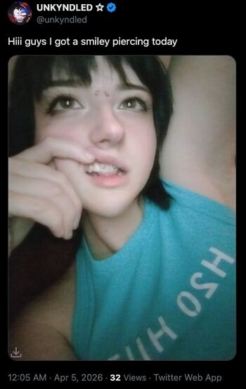 Unkyndled page leaked private photo uncensored HD quality